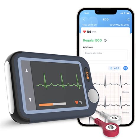 ecg test machine|best at home ecg monitor.